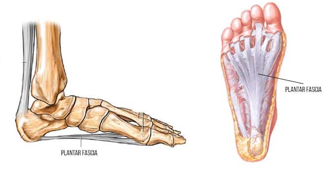 Heel And Arch Pain, What Can I Do? - Waverley Foot Clinic