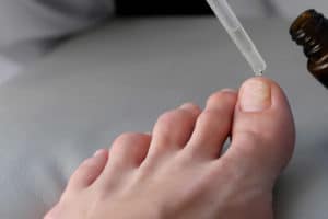 Over the counter fungal nail treatments